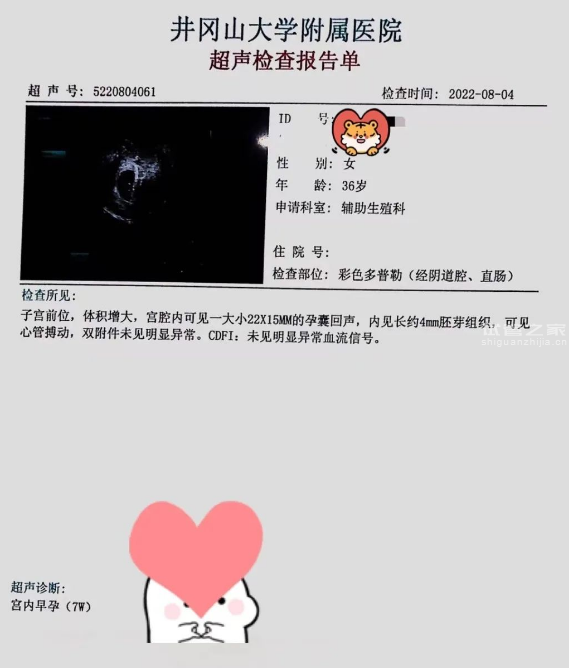 惠州54岁助孕龙凤胎-自发流产5次的高龄产妇试管婴儿冷冻移植成功!